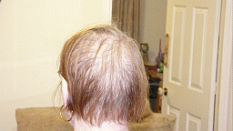 hair