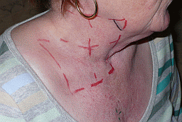 second
x marks the spot